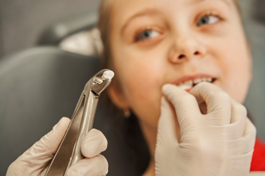 Candy Care Pediatrics Tooth Extractions 2