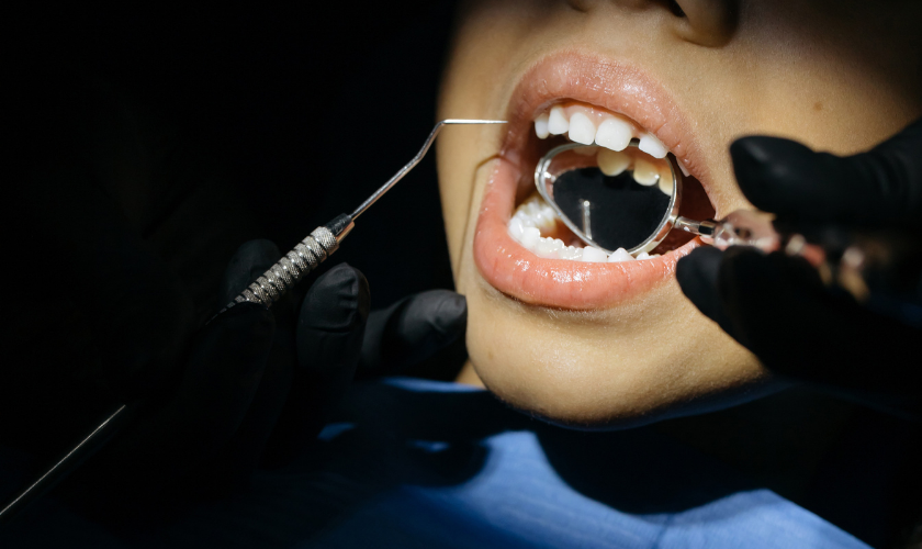 Candy Care Pediatrics Space Maintainers 3